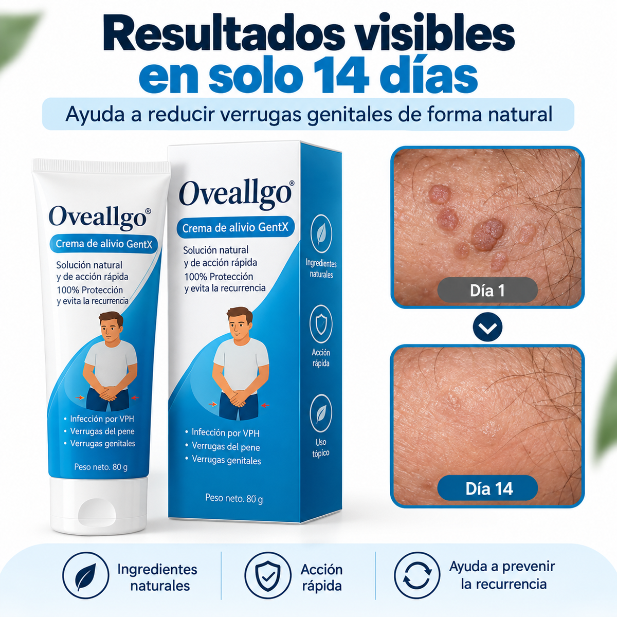 Crema para el alivio Oveallgo®